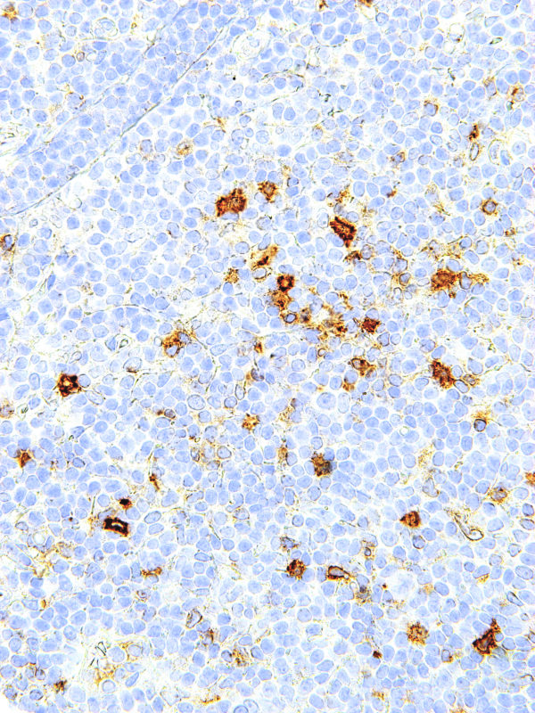 OX40-IHC140-Tonsil (Mouse)