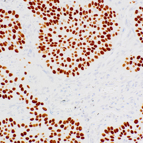 P40-IHC058-Lung