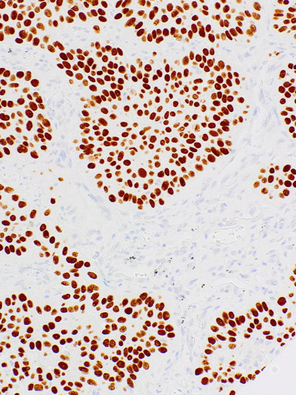 P40-IHC058-Lung