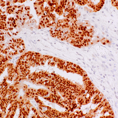 PAX9-IHC008-Ovary