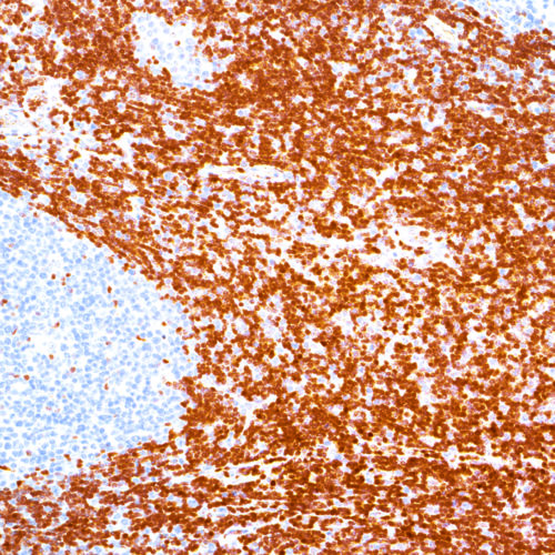 p27-IHC027-Lymph-Node