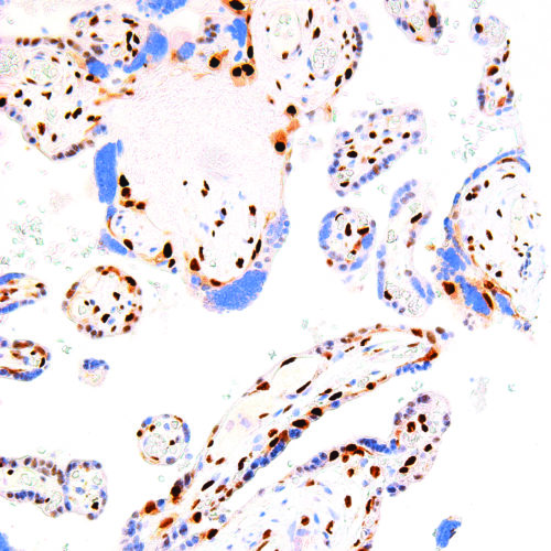 p57-Kip2-IHC057-Placenta (Rabbit)